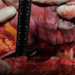 Chinese nurse stabbed to death