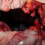 Chinese nurse stabbed to death