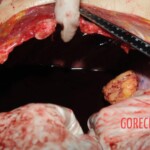 Chinese nurse stabbed to death