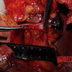 Chinese nurse stabbed to death