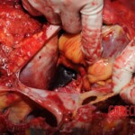 Chinese nurse stabbed to death