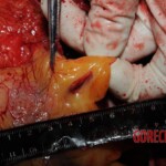 Chinese nurse stabbed to death