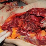 Chinese nurse stabbed to death