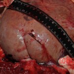 Chinese nurse stabbed to death