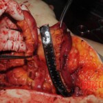 Chinese nurse stabbed to death