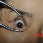 Nurse stabbed to death