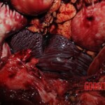 Chinese nurse stabbed to death