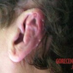 Polish woman hit by car