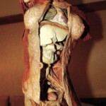 Plastinated female body