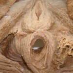 Plastinated female body