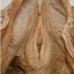 Plastinated female body