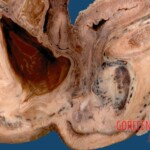 Plastinated female body