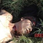 Raped and slashed woman