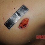 Stabbed woman in morgue