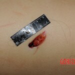 Stabbed woman in morgue