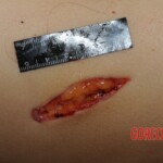 Stabbed woman in morgue