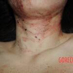 Stabbed woman in morgue