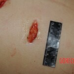 Stabbed woman in morgue