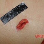 Stabbed woman in morgue