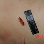 Stabbed woman in morgue