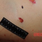 Stabbed woman in morgue