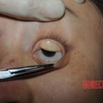 Stabbed woman in morgue