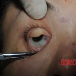 Stabbed woman in morgue