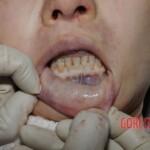 Stabbed woman in morgue