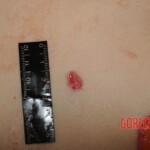 Stabbed woman in morgue