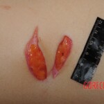 Stabbed woman in morgue