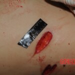 Stabbed woman in morgue