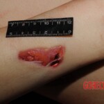 Stabbed woman in morgue