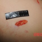 Stabbed woman in morgue