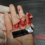 Stabbed woman in morgue