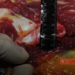 Stabbed woman in morgue