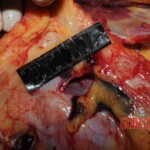 Stabbed woman in morgue