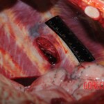 Stabbed woman in morgue