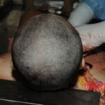 Stabbed woman in morgue