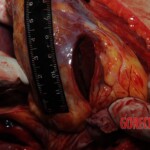 Stabbed woman in morgue