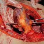 Stabbed woman in morgue