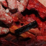 Stabbed woman in morgue