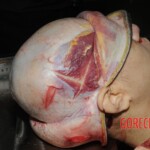 Stabbed woman in morgue