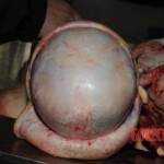 Stabbed woman in morgue