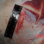 Stabbed woman in morgue