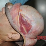 Stabbed woman in morgue