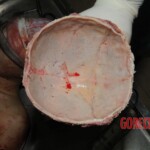 Stabbed woman in morgue