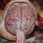 Stabbed woman in morgue