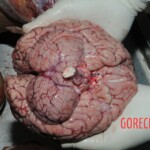 Stabbed woman in morgue