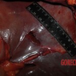 Stabbed woman in morgue