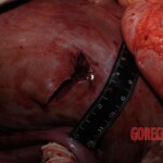 Stabbed woman in morgue